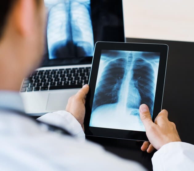 Bachelor of Science in X-Ray Technology